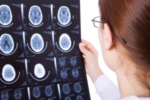 Female doctor examining a brain cat scan (injury, brain, head)
